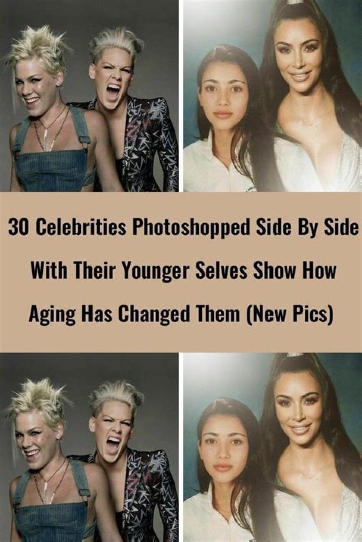 30 Celebrities Who Have Had Bell’s Palsy Cool Dump
