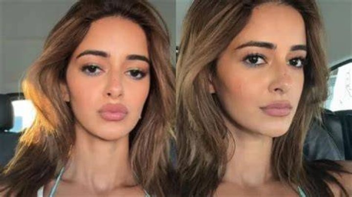 Alanna Panday's Plastic Surgery Journey: Before And After