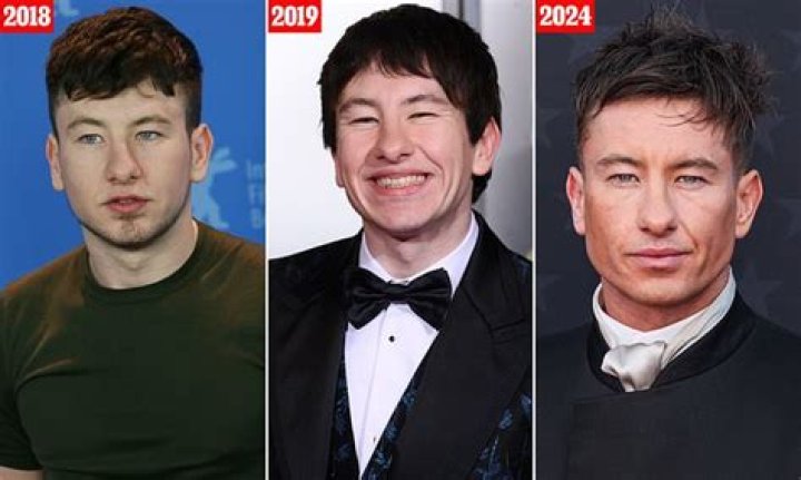 Barry Keoghan Plastic Surgery: Before And After Transformation