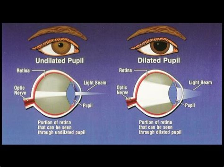 Eyeopening pictures shine light on symptoms of astigmatism CTV News