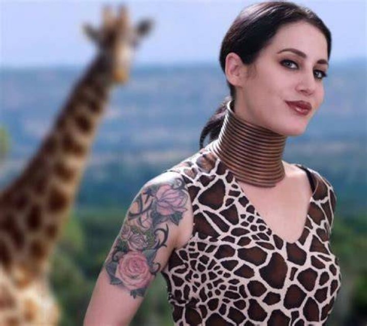 Giraffe Woman Removes Rings After Fiver Years How She Looks Now