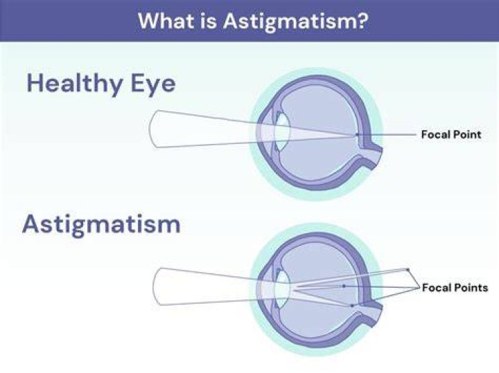 Glasses For Astigmatism Cheapest Retailers, Save 64 jlcatj.gob.mx