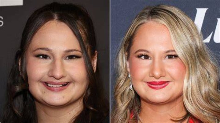 Gypsy Rose's Nose Job: Everything You Need To Know