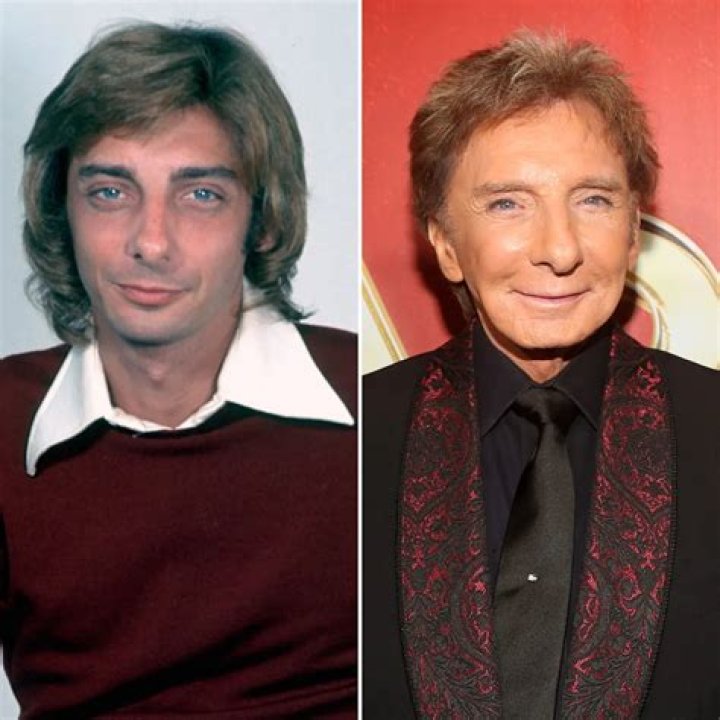 Has Barry Manilow Had Plastic Surgery? See the Singer's Transformation!
