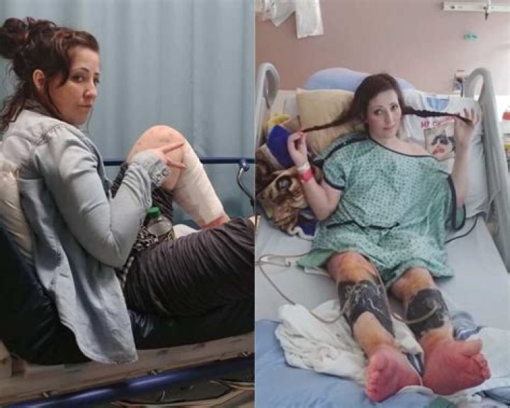 Kelly Ronahan Legs Amputated Was Her Leg Sores Due To Munchausen
