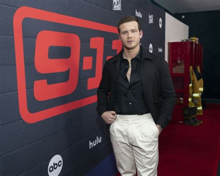 ‘911’ Actor Oliver Stark on His Eye Birthmark It’s Not Herpes