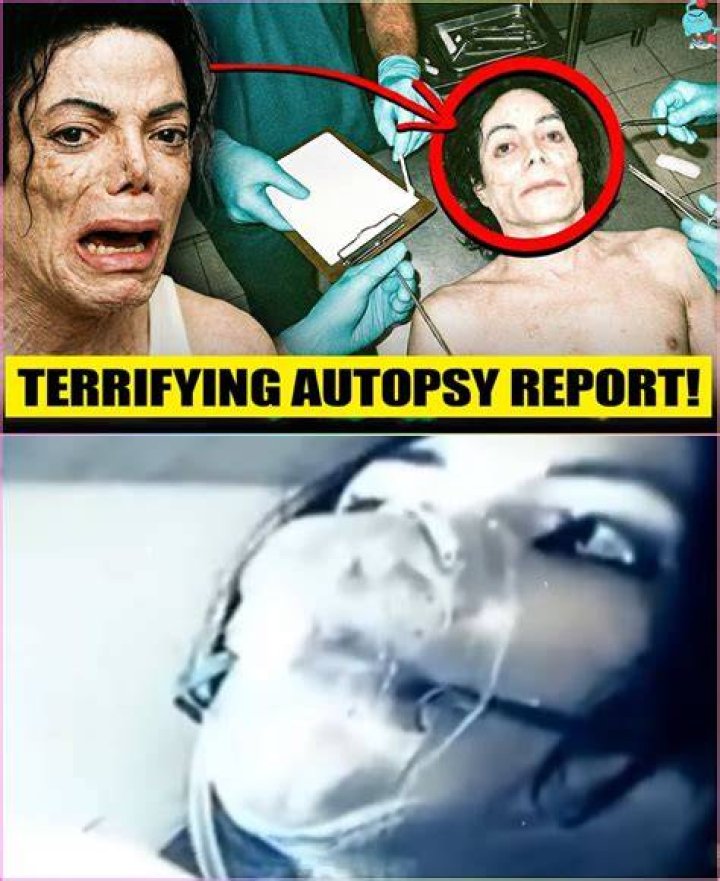 Michael Jackson Autopsy Reveals A Secret The Costa Rican Times