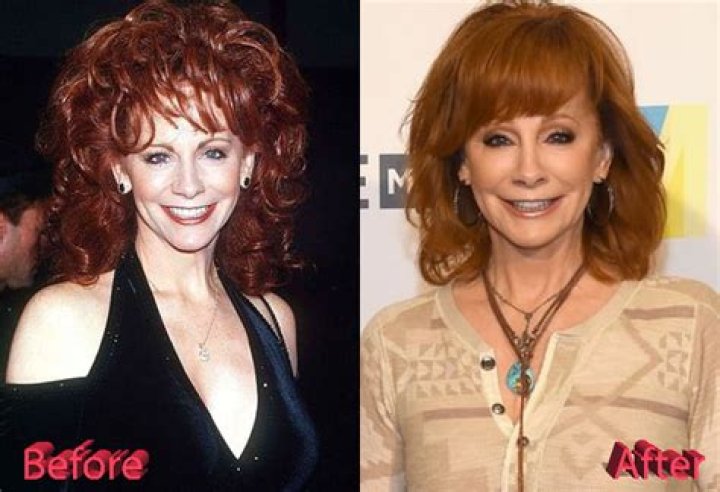 Reba Mcentire Plastic Surgery What Did Her Fan Tweet About Her Plastic