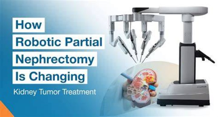 Robotic Partial Nephrectomy Stony Brook University School of Medicine
