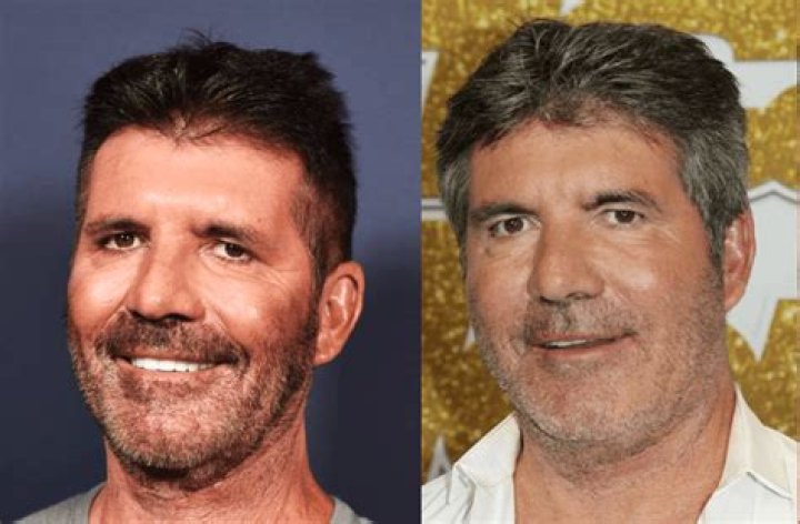 Simon Cowell Before And After Pictures What Happened With Simon Cowell?