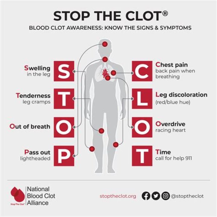 Symptoms Of Blood Clot In Leg After Pregnancy