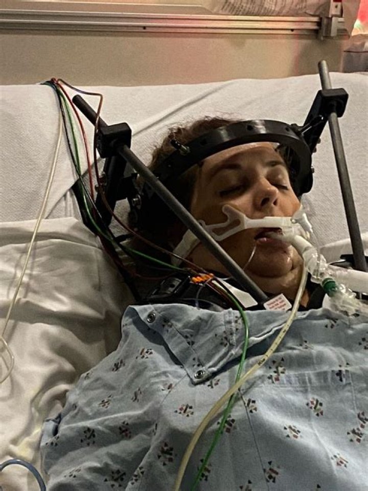UAB care team leads patient through lifechanging internal decapitation