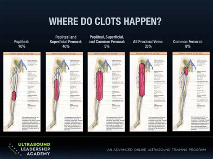 Ultrasound Leadership Academy Lower Extremity DVT — EM Curious