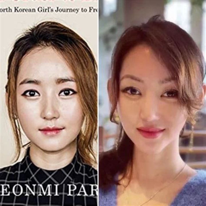Yeonmi Park Plastic Surgery Did She Have Breast Implants?